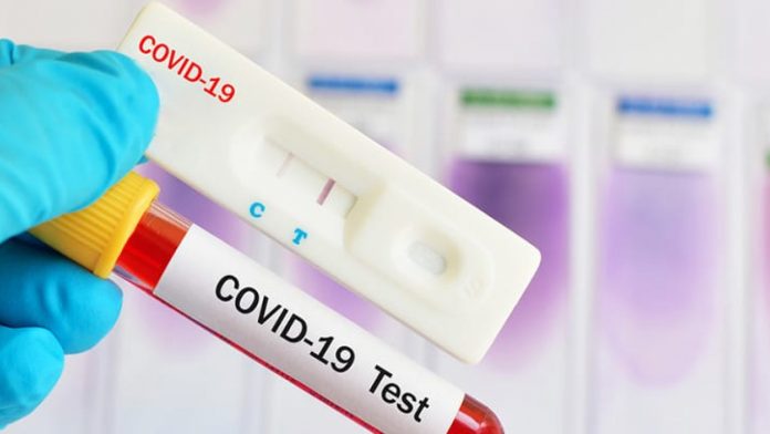 test covid