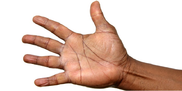 palma de la mano