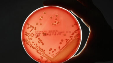 bacteria