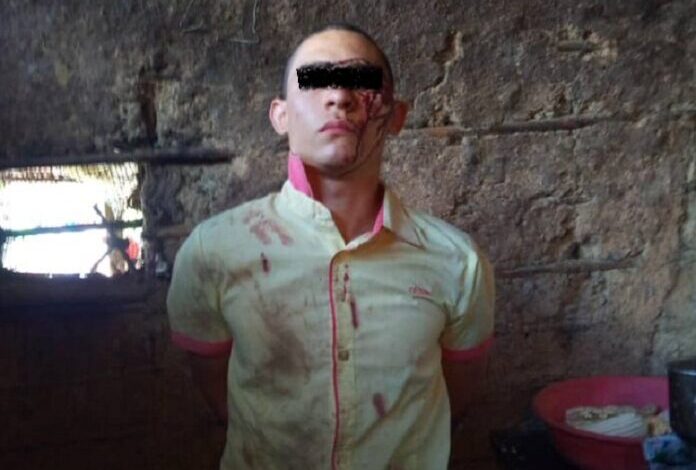 asesino de sanare