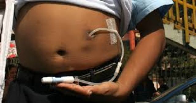 renal