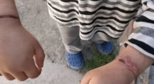 niño atado con alambres