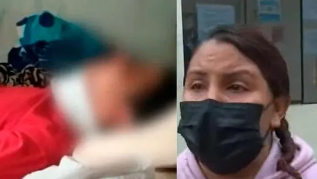 ¡Bullying! Golpean en una escuela en Perú a un niño venezolano de 11 años y le ocasionan derrame cerebral