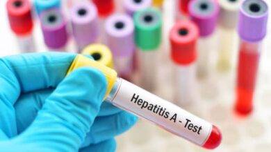 hepatitis