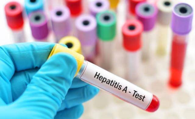 hepatitis