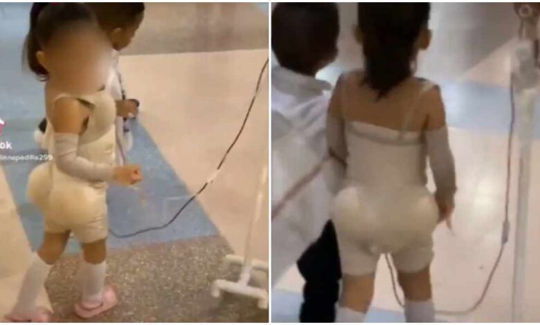 niña operada